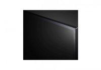 LG 65UP7500PTZ 65 Inch (164 cm) Smart TV